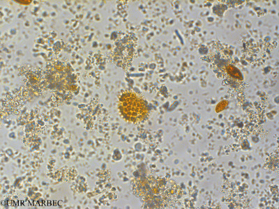 phyto/Pertuis Charentais/Tasdon_st6/PAMPAS 2019-2021/Pseudopediastrum boryanum (old Pediastrum boryanum -TASDON_St6_r1_221119-005).tif(copy)_thumb.jpg